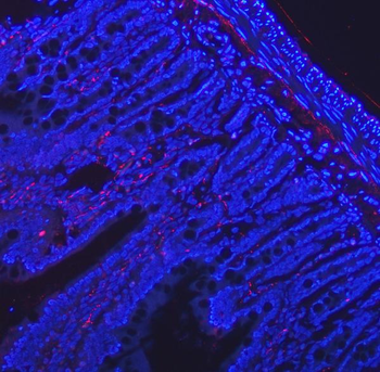 VIP peptides VIP Rabbit Polyclonal Antibody