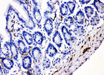 VIP peptides VIP Rabbit Polyclonal Antibody