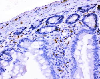 VIP peptides VIP Rabbit Polyclonal Antibody