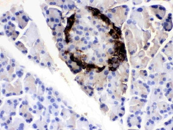 VIP peptides VIP Rabbit Polyclonal Antibody