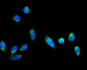 AFG3L2 Rabbit Polyclonal Antibody