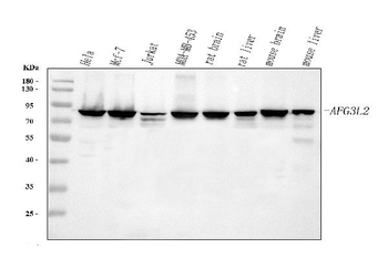 AFG3L2 Rabbit Polyclonal Antibody