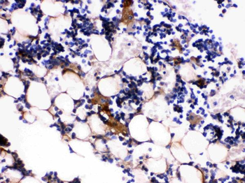 Osteocalcin/BGLAP Rabbit Polyclonal Antibody