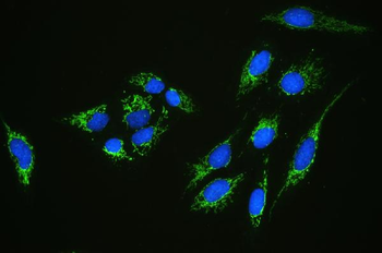 GC1q R/C1QBP Rabbit Polyclonal Antibody
