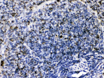 GC1q R/C1QBP Rabbit Polyclonal Antibody
