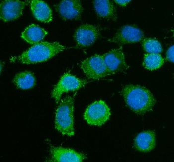 Caldesmon/CALD1 Rabbit Polyclonal Antibody
