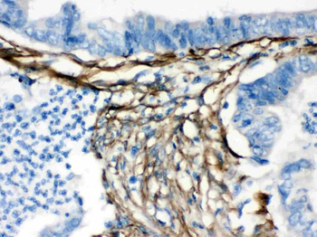 Caldesmon/CALD1 Rabbit Polyclonal Antibody