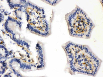 Caldesmon/CALD1 Rabbit Polyclonal Antibody