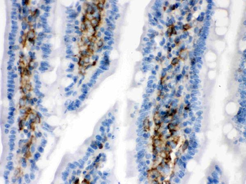 Caldesmon/CALD1 Rabbit Polyclonal Antibody
