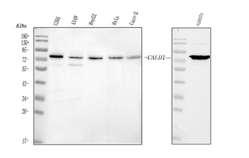 Caldesmon/CALD1 Rabbit Polyclonal Antibody