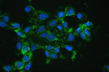 Catalase Rabbit Polyclonal Antibody