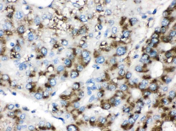 Catalase Rabbit Polyclonal Antibody