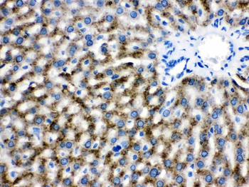 Catalase Rabbit Polyclonal Antibody
