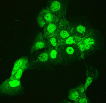CCT3 Rabbit Polyclonal Antibody