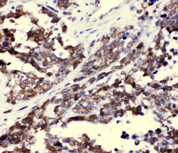 CCT3 Rabbit Polyclonal Antibody