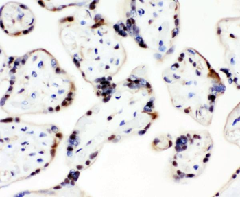 CCT3 Rabbit Polyclonal Antibody