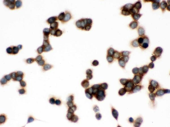 TCP1 delta/CCT4 Rabbit Polyclonal Antibody
