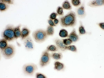TCP1 delta/CCT4 Rabbit Polyclonal Antibody