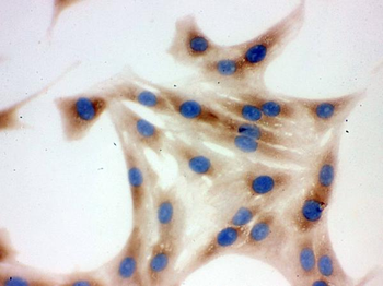 TCP1 delta/CCT4 Rabbit Polyclonal Antibody