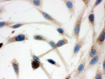 TCP1 delta/CCT4 Rabbit Polyclonal Antibody