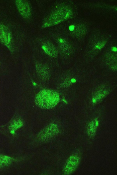 TCP1 delta/CCT4 Rabbit Polyclonal Antibody