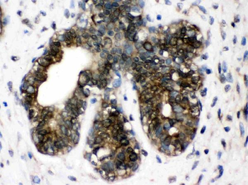TCP1 delta/CCT4 Rabbit Polyclonal Antibody