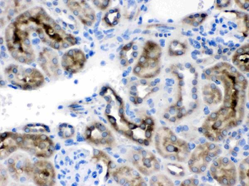 TCP1 delta/CCT4 Rabbit Polyclonal Antibody