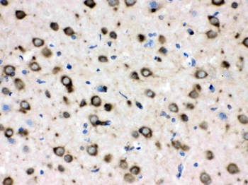 TCP1 delta/CCT4 Rabbit Polyclonal Antibody