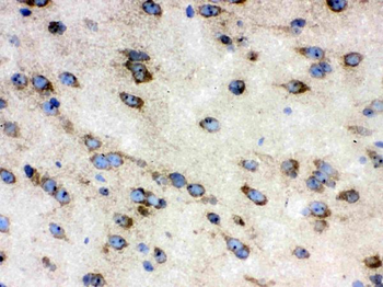 TCP1 delta/CCT4 Rabbit Polyclonal Antibody