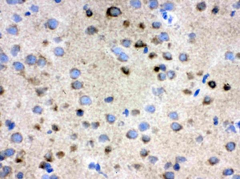 TCP1 delta/CCT4 Rabbit Polyclonal Antibody