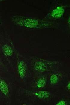 TCP1 epsilon/CCT5 Rabbit Polyclonal Antibody
