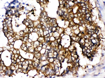 TCP1 epsilon/CCT5 Rabbit Polyclonal Antibody