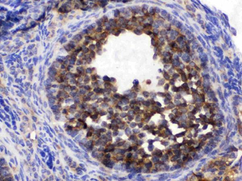 TCP1 epsilon/CCT5 Rabbit Polyclonal Antibody
