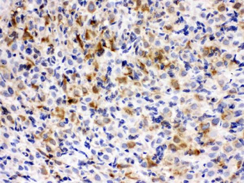 TCP1 epsilon/CCT5 Rabbit Polyclonal Antibody