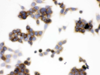 TCP1 epsilon/CCT5 Rabbit Polyclonal Antibody