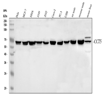 TCP1 epsilon/CCT5 Rabbit Polyclonal Antibody