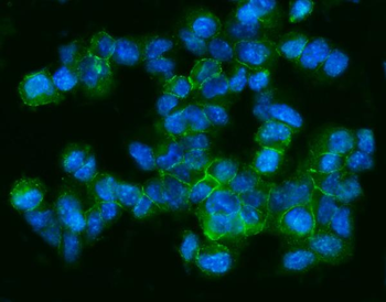 CD9 Rabbit Polyclonal Antibody
