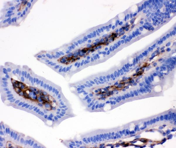 CD9 Rabbit Polyclonal Antibody