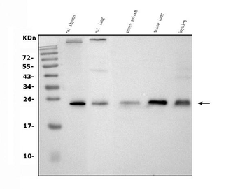 CD9 Rabbit Polyclonal Antibody
