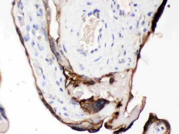 CDCP1 Rabbit Polyclonal Antibody