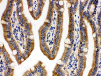 CDCP1 Rabbit Polyclonal Antibody