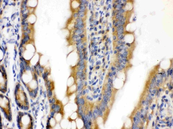 CDCP1 Rabbit Polyclonal Antibody