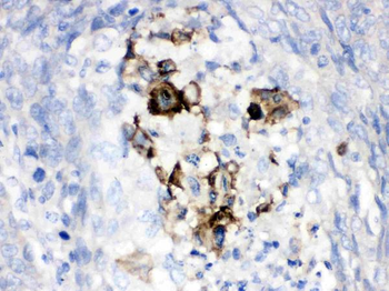 Factor B/CFB Rabbit Polyclonal Antibody