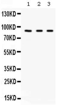 Factor B/CFB Rabbit Polyclonal Antibody