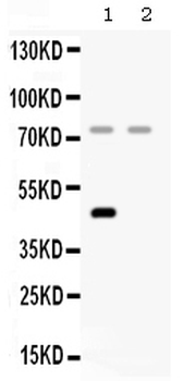 Factor I/CFI Rabbit Polyclonal Antibody