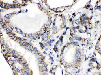 Calcitonin/CALCA Rabbit Polyclonal Antibody
