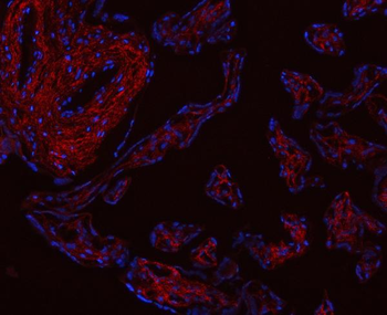 Collagen I/COL1A1 Rabbit Polyclonal Antibody