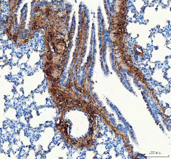 Collagen I/COL1A1 Rabbit Polyclonal Antibody