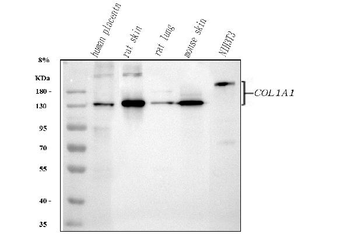 Collagen I/COL1A1 Rabbit Polyclonal Antibody