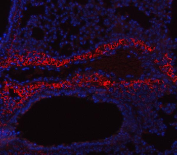 Collagen I/COL1A1 Rabbit Polyclonal Antibody